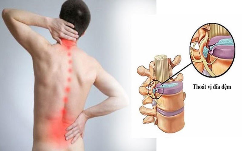 Ghế massage hỗ trợ giảm đau lưng hiệu quả